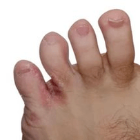 Pilz zwischen den Fingern